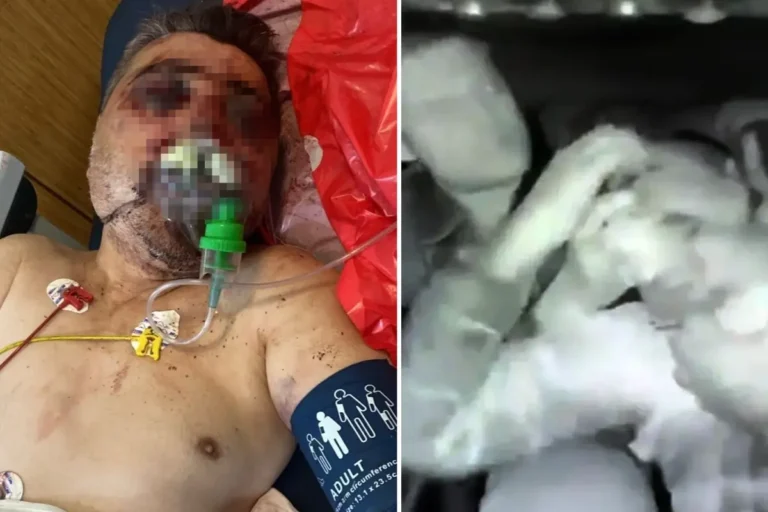 İngiliz boksörün Türk şoförü komalık ettiği anlar kamerada
